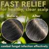 Tea Tree Scalp Scrub | Antifungal Itchy Scalp Treatment with Tea Tree Oil, Quartz Powder & Sea Salt | Gently Exfoliates, Relieves Dryness, Fights Dandruff, Promotes Healthy Hair Growth & Scalp Relief view 4