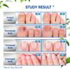 Fungus Treatment for Toenails, Toe Nail Fungus Treatment Extra Strength, Toenail Fungus Treatment, Fast Acting - 2 Packs, Black view 4