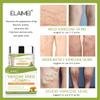 Varicose Vein Cream for Legs - Improves Blood Circulation, Reduces Spider Veins and Heaviness, Relieves Phlebitis VeinsTreats Spider Veins in LegsImproves Leg Appearance (3) view 4
