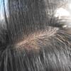 WigVivid Ultra Thin Skin Toupee Hair for Men Real Human Hair Piece All V-looped 0.06mm Hair Replacement System Mens Toupee#1B40 Natural Black+40% Gray-100% Density view 4