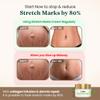 NinthAvenue Basics VEDA Stretch Mark Cream for Women/Girls (100gm, Pack of 1) | Scar Removal and Moisturizing Cream, Stretch Mark Removal for Stomach, Thighs & All Body Parts view 2