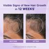 Bare Anatomy Nature x Science Rosemary Hibiscus Hair Growth Oil for Women & Men | Helps Hair Growth & Strengthens Hair | Nourishes Scalp & Controls Hair Fall | Suitable for All Hair Types-100ml view 2