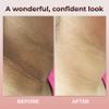 ABERA Collagen Neck Cream for Anti-Wrinkle & Acanthosis Nigricans with Niacinamide, Even Tone Moisturizer, UV Protection, Built-in Massage Roller (1.76 Fl Oz) view 3