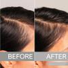 Scalpify Advanced Hair Serum | Nourishing Scalp Serum Non Oily Treatment for Enhanced Hair Support and Thickness | Perfect for Men & Women | 30mL view 2