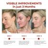 ABERA Saffron Serum For Melasma Treatment, Renewing for Face, Anti-Aging Treatment for Fine Lines & Wrinkles, High Potency Saffron Extract, Hydrating Serum, Dark Spot Remover (2 BOXES) view 4