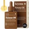 Keyoma Batana Oil for Hair Growth with Rosemary: Nourish & Detox Scalp for Thicker, Stronger, Longer Hair - 100% Organic Batana Oil from Honduras - Reduce Hair Loss (30 mL) view 1