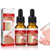 2PCS Ingrown toenail drops,Ingrown Toenail Relief,Easy Trim Ingrown Toenail Tools,Toenail Fluid With Silicone Gel Toe Caps Essential Oil Diffuser,Ingrown Toenail Reliever and Softener Kit view 1
