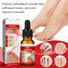 2PCS Ingrown toenail drops,Ingrown Toenail Relief,Easy Trim Ingrown Toenail Tools,Toenail Fluid With Silicone Gel Toe Caps Essential Oil Diffuser,Ingrown Toenail Reliever and Softener Kit view 2