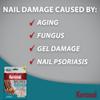 Kerasal Multi-Purpose Nail Repair Patches - 14 Count Twin Pack - Kerasal Nail Repair for Damage, 8-Hour Treatment Restores Healthy Appearance (Packaging May Vary) view 4