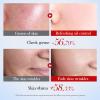 Snail Mucin Cleanser, Unisex Snail Mucin Face Wash, Snail Face Wash - Repairing and Daily Deep Cleansing for Dry & Sensitive Skin view 3
