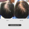DS Labs for Men & Women StimuROLLER Scalp Roller 0.25 mm - Cosmetic Micro Needle Roller for Scalp Care Routine, Stainless Steel Precision Roller for At Home Beauty Use view 4