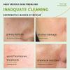 BLMBAY 3 PCS Aloe Vera Gel Smoothing After Sun Deeply Hydrating Nourishing Skin Care, for Face Body and Hair - Sunburn, Redness and Itchy Skin Relief 1.41 Fl Oz view 3