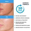 Name Skin Care Korean Carboxy CO2 Therapy Face & Neck Mask Set of 2 - Hydrating Oxygen Carboxytherapy Skincare Sheet Masks - Moisturizing Anti Aging Pore Tightening Brightening Facial Treatment Gel view 4