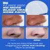 One-day's you P.Z SSOC SSOC No More Blackhead Nose Strips Sebum & Pore Care | Hypoallergenic Korean Nose Mask Blackhead Remover Clogged Pore Tightening Skin Care w/Centella Asiatica (0.07 oz, 5 EA) view 3