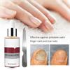 1PC Nail Treatment Nail Renewal Solution Toenails & Fingernails Nail Repairs Essential Oil Protects From Discoloration, Brittle And Cracked Nail(12ML) 111 view 2