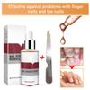 1PC Nail Treatment Nail Renewal Solution Toenails & Fingernails Nail Repairs Essential Oil Protects From Discoloration, Brittle And Cracked Nail(12ML) 111 view 4