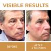 ABERA Natural Repair Eye Cream, Minimizes Under Eye Bags & Puffiness, Reduce Wrinkles, Fine Lines and Dark Circles, 0.5 fl oz view 4