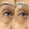 Dr. Brandt Needles No More, No More Baggage Bundle - Minimizes Under-Eye Bags, Puffiness & Dark Circles - Full (0.5 oz) + Travel Size (0.25 oz) view 2