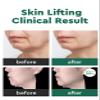 Bewants Eye Serum Stick for Hydrating & Lifting Cream for Neck & Dcollet Wrinkle Care with 61% Bamboo Water & Cica, 1.01 fl.oz view 3