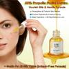 60% Propolis Facial Serum for Acne Prone Oily Skin - Oil Control, Deep Hydration & Pore Minimizing - Natural Extract to Smooth Skin & Balance Complexion, 1 Fl Oz view 2