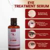 Styes Eye Relief Serum, 2PCS Moisturize Blepharitis & Chalazion Remover, Gentle Under Eyelid Serum For Dark Circles, Puffiness. view 2