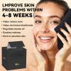 Ditoi Face Towels, Disposable Black Paper Towels, Light Exfoliation for Oily Skin,Facial Towels XL for Makeup Remover & Skincare,10"12", 50 Count view 2