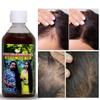 Adivasi Neelambari Hair care oil - hair oil for Hair Growth oil |with Rosemary Oil, Castor Oil, Argan Oil, Raw Batana Oil | For Women and Men (Pack of 4) view 3