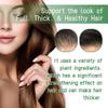 Phillauri Rosemary Hair Oil Spray & Mist - For Healthy Hair, Hair Growth | Rosemary Water Spray for Hair Growth | Hair Growth Spray for Thicker and Healthier Hair | Hair fall control view 3