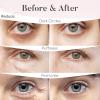 BLOOMORA Rose Under Eye Patches (30 Pairs) - Under Eye Mask for Appearance of Dark Circles - For Puffy Eyes Smoothing - Skincare Mask view 4