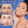 Anti Wrinkle Face Tape | Skin Tape for Wrinkles | Facial Myofascial Lift Tape for Skin | Wrinkle Tape for Face & Forehead | Facial Tape for Wrinkles | Anti Aging Tape for Wrinkles Overnight 2 Rolls view 3