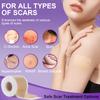 Silicone Scar Sheets, Medical Grade Silicone Scar Tape (1.6" x 120"), Professional Scar Removal Treatment, Reusable, for Healing Keloids, Surgeries Scars, C-sections, and Burns view 3
