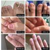 1PC Nail Repairs,Nail Treatment Nail Renewal Solution Toenails & Fingernails Nail Repairs Essential Oil Protects From Discoloration, Brittle And Cracked Nail(12ML) view 2