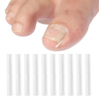 10 Pcs Ingrown Toenail Correction Strips Brace Kit, Ingrown Toenail Corrector Straightener Strips Recover Clips Toenails Thick Pedicure Tool Straightener Strip for Men Women Foot Care Tool(ZS227)