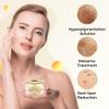 ABERA Tr Nm Kasumi, Kem M Tn Nhang, Dng Trng Da Cao Cp Nht Bn, Gim i Mi, Melasma Treatment For Face (1.05 Oz Per Item) view 2