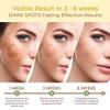 ABERA Tr Nm Kasumi, Kem M Tn Nhang, Dng Trng Da Cao Cp Nht Bn, Gim i Mi, Melasma Treatment For Face (1.05 Oz Per Item) view 3