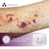 Arnique Arnica Bruise Cream Balm with Vitamin K  Bruise Cream for Seniors with Thin, Mature, Elderly Skin- Fragile Skin Moisturing Formula legs, arms, hands view 4