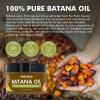 Dolahair Batana Oil for Hair Growth Organics 100% Natural Pure Batana Hair Oil Batana Oil Nourishes Damaged Hair raw Batana Butter Prevent Hair Loss Natural Hair Growth Oil and Conditioner, Beige view 2