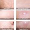 Generic Acne Patch Kit, Anti-Acne Patch for Oily Skin, Pack of 72 view 2