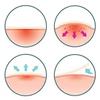 Generic Acne Patch Kit, Anti-Acne Patch for Oily Skin, Pack of 72 view 3