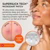 ZitSticka Killa Pimple Patches for Face - World's Most Potent Pimple Patch with Fast-Acting Microdarts - Starts Working within 6 Hours for Deep, Early-Stage Zits - Mini 16 Count view 2