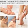 Mouriven 2 Packs Urea Cream 40 Percent - Foot & Hand Cream, for Dry, Cracked Heels, Feet, Knees, Elbows, and Hands, Callus Remover, Maximum Strength Urea Lotion for Softening and Moisturizing view 4