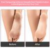 2 Pairs Silicone Socks Silicones Moisturizing Sock for Dry Cracked Feet Soft Gel Socks Foot Care for Women Softening Calluses Repairing Rough Dry Feet Skin view 3