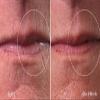 City Beauty City Lips Line Therapy - Lip Line Fortifying Treatment - Defining & Smoothing - Solution for Lipstick Lines, Vertical Wrinkles, Corner Creases - Anti-Aging Cruelty-Free Skin Care view 3