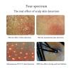 11 inch UV Skin Analyzer Professional Scalp Detector Hair Follicles Oil Moisture Tester Facial Skin Hair Analyzer Machine view 4