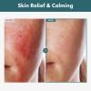 TOSOWOONG Adenosine Cica Cream, 520,000ppm Centella Asiatica, Redness Reducing for Oily and Dry Skin Moisturizer, Barrier Cream with Niacinamide and Panthenol, Korean Skincare, 100ml, 3.38 fl. oz. view 2