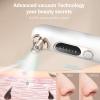 Blackhead Remover Pore Vacuum Kit for Face, 5 Adjustable Suction Levels Blackhead Extraction Tool, Face Suction Pore Cleaner with 4 Suction Heads, 4 Probes for Women & MenWhite view 4