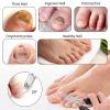 CIATBYYJ Ingrown Toenail Clippers with Ingrown Nail Lifter, Heavy Duty Toe Nail Clippers, Medical Ingrown Toenail Treatment Trimmer Pedicure Tools for Adults & Seniors, Easy to Grip and Cut view 4