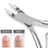 Ingrown Toenail Nail Cuticle Scissors Stainless Steel Nail Cutter Clipper for Manicure Pedicure Dead Skin Nipper Eagle Beak Pliers Nail Art Tool view 2