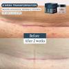 Luna Daily Stretch Mark & Scar Treatment Gel | Daily Repair Moisturizer for Body, Acne & Post-Surgery Scars | With Arnica & Hydrating Actives | Supports Skin Healing, Smoothness & Recovery, 50ml view 4