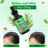 Clean Beauty Rosemary Hair Oil For Growth with Castor Oil Batana Oil Pumpkin Seed Oil Peppermint Oil Silica Biotin Collagen Keratin Saw Palmetto Horsetail Tea Tree Vit E Aloe Vera Jojoba (1 Pack) view 4